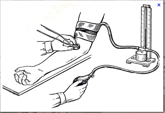Давление рисунок. Измерение ад ручным тонометром метод Короткова. Измерение давления тонометром алгоритм. Измерение давления ручным тонометром (метод Короткова). Измерение артериального давления рисунок.